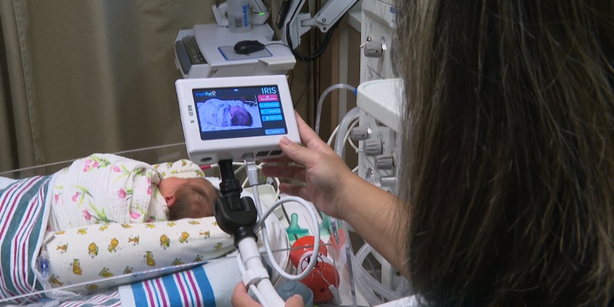 Normal Angel Camera MEDICAL MONDAY: Angel Eye camera allows parents to see NICU babies