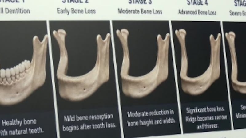 Talking teeth! Answering frequently asked questions with Panama City Implants and Periodontics.