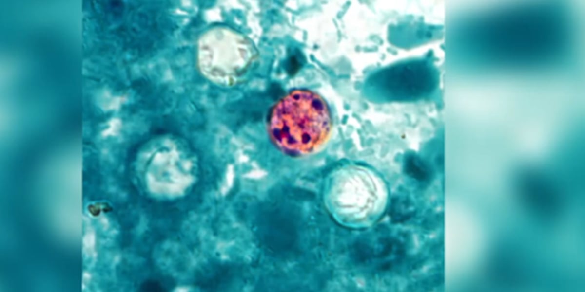 Brote de ciclosporiasis: los expertos en salud recomiendan cocinar todos los productos